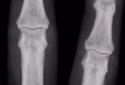 X-Ray Scanner screenshot 1