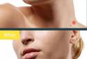Retouch screenshot 2